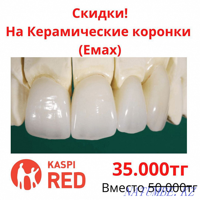 Ceramic crowns Dentistry Almaty Tooth extraction Veneers Braces Almaty - photo 1