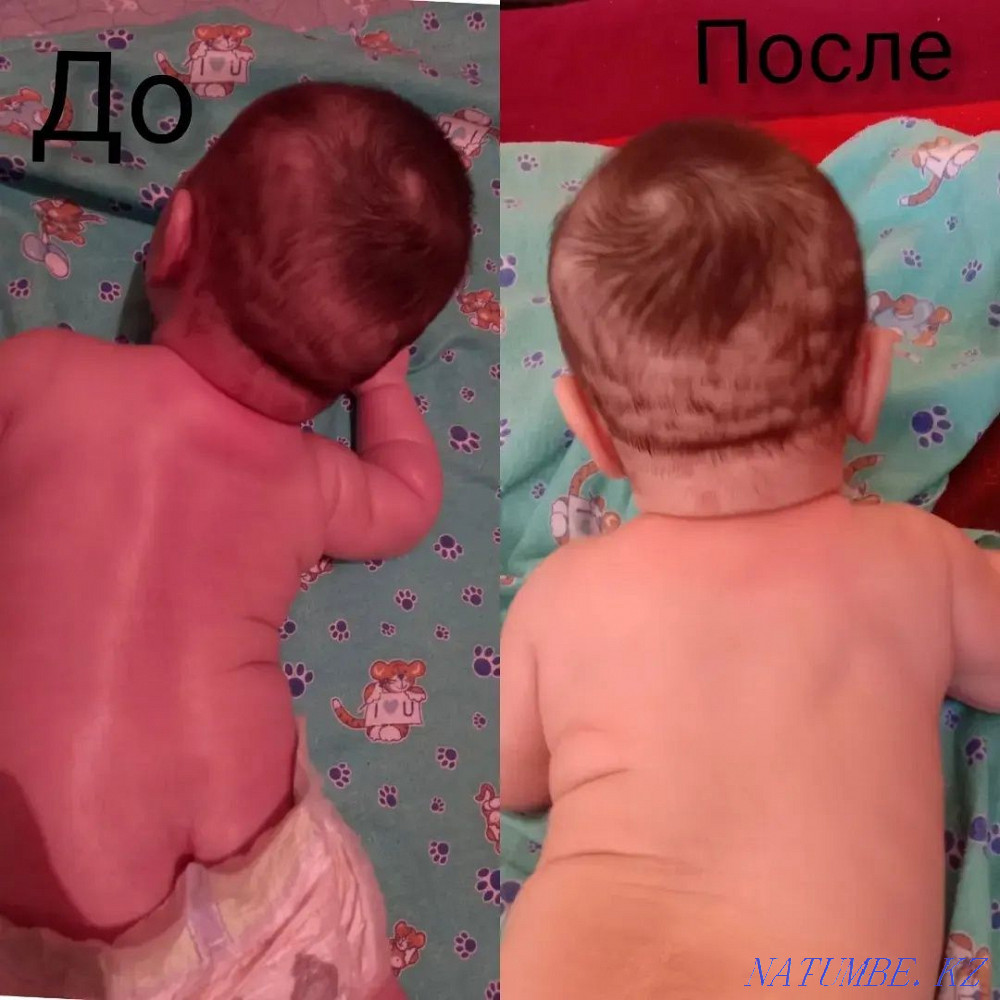 Детский массаж Шымкент Аксукент - изображение 2