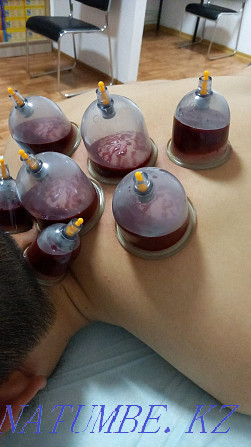 Hijama massage Atyrau - photo 8