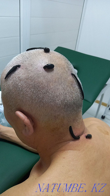 Хиджама массаж Атырау - изображение 7