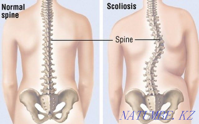 Массаж сертифицированный Актау - изображение 4