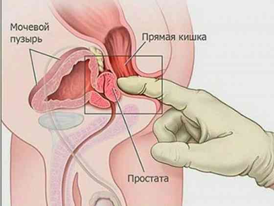 Массаж мужское здоровье/Урологический/Простата. Astana