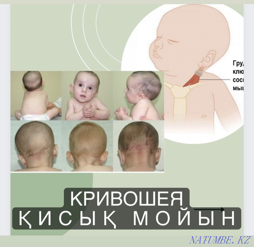 Professional Children's Masseur Shymkent. Shymkent - photo 3