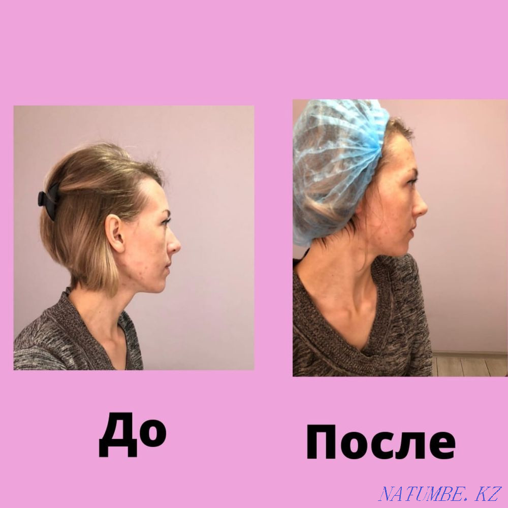 Массаж. Общий, укрепляющий, коррекционный. Караганда - изображение 7