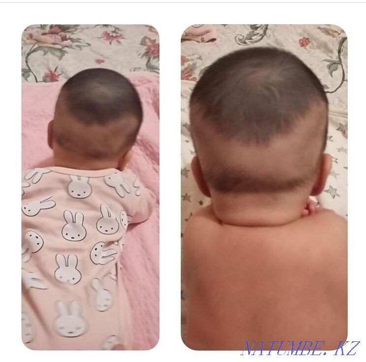 Children's massage with departure Almaty - photo 2