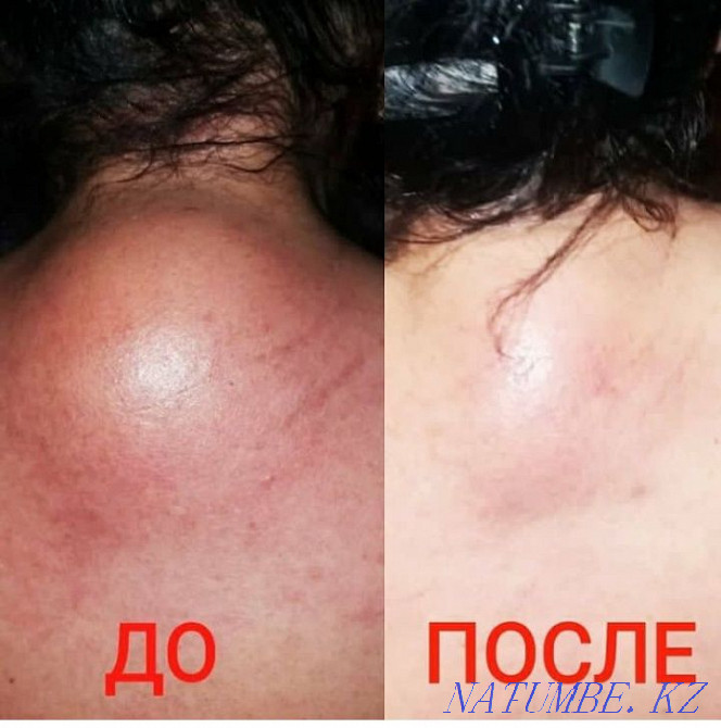 Массаж взрослый и детский Туздыбастау.РАЗБИВАЮ ПРОТОКИ КОРМЯЩИМ  - изображение 7