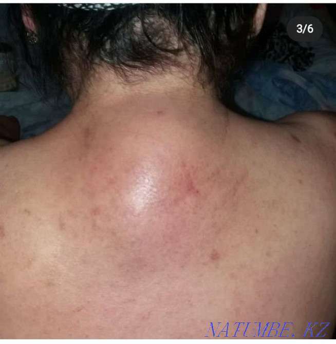 Массаж взрослый и детский Туздыбастау.РАЗБИВАЮ ПРОТОКИ КОРМЯЩИМ  - изображение 6