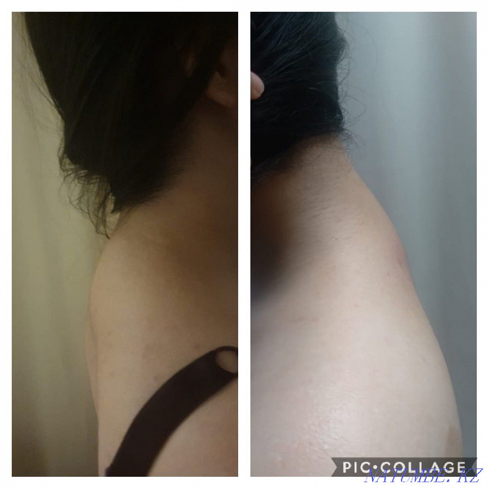 Promotion for all types of massage Astana - photo 2