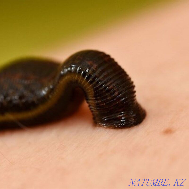 Лечение пиявками хиджама Атырау - изображение 1