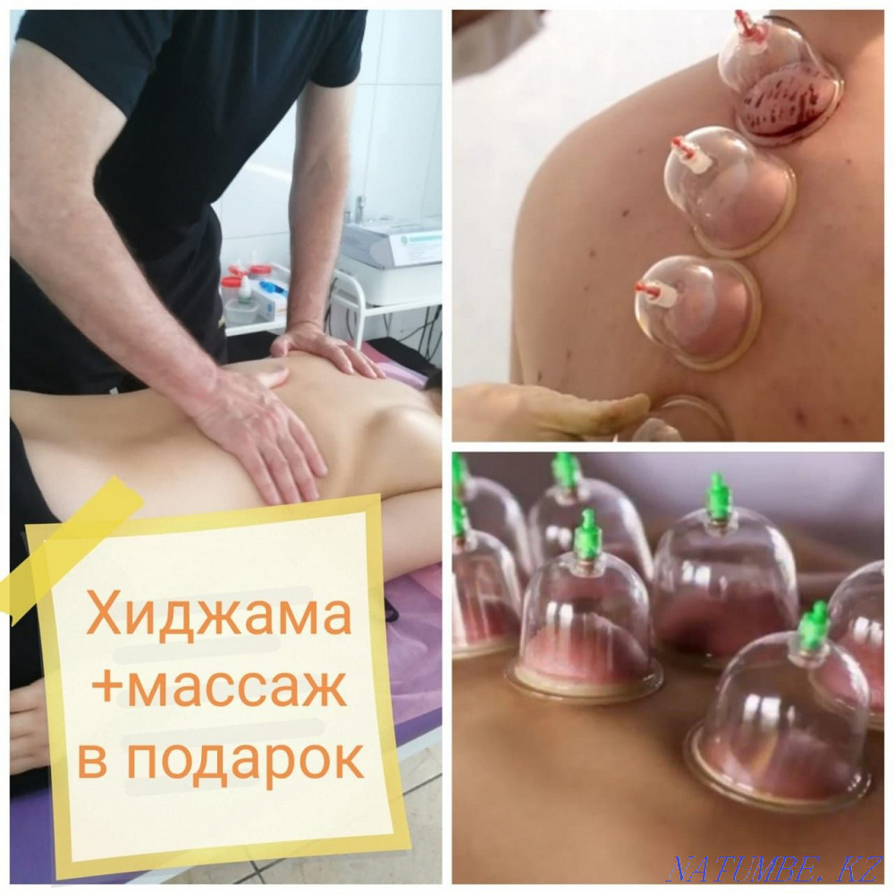 Массаж, хиджама, физеотерапия Алматы - изображение 2