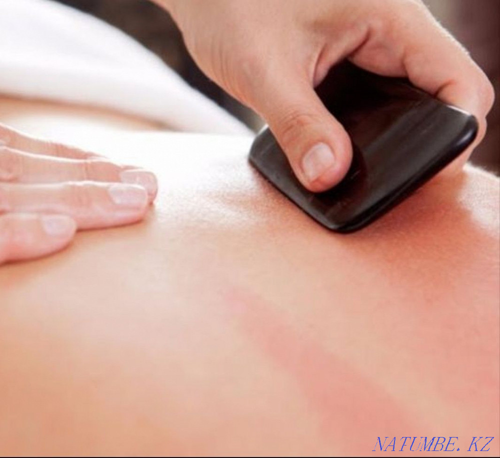 Массаж, хиджама, физеотерапия Алматы - изображение 5