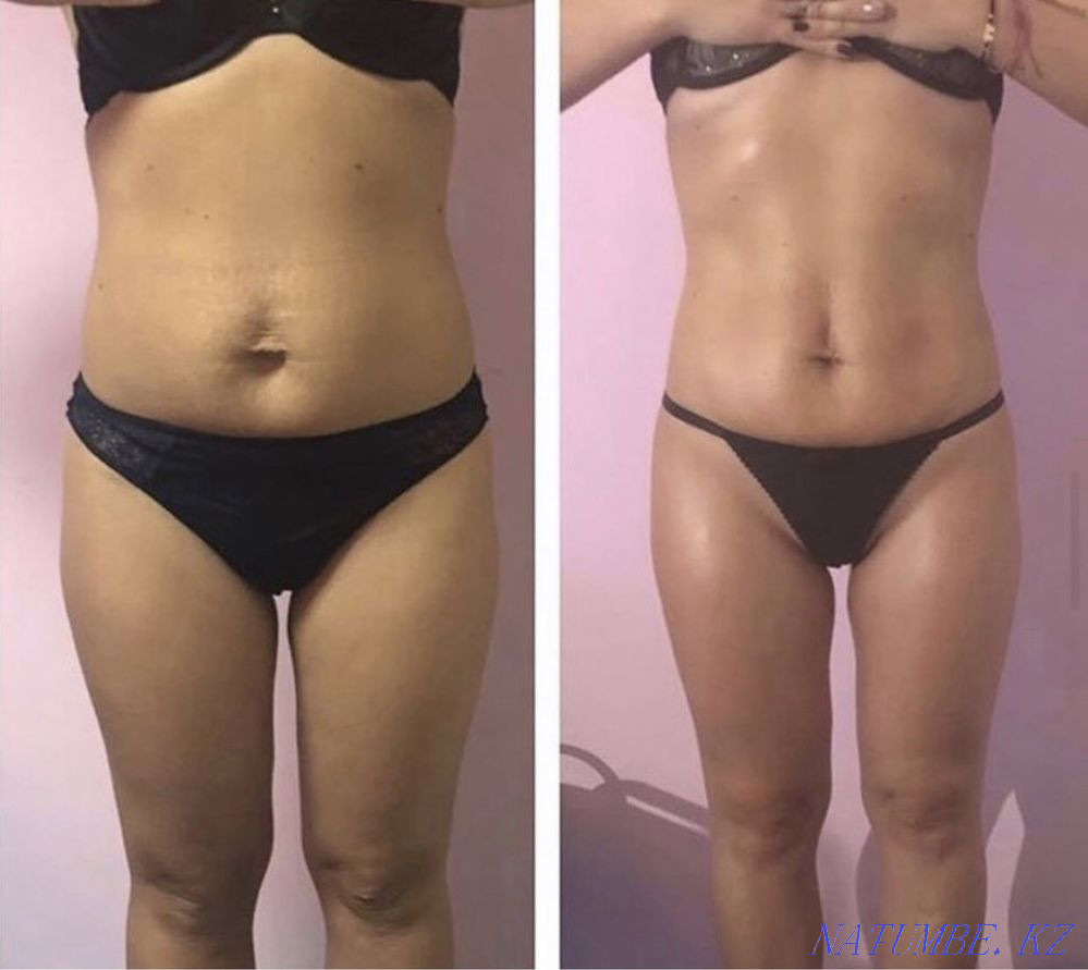 Masseur Astana - photo 3