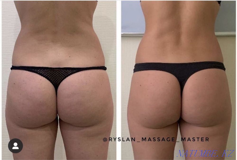 Masseur Astana - photo 6