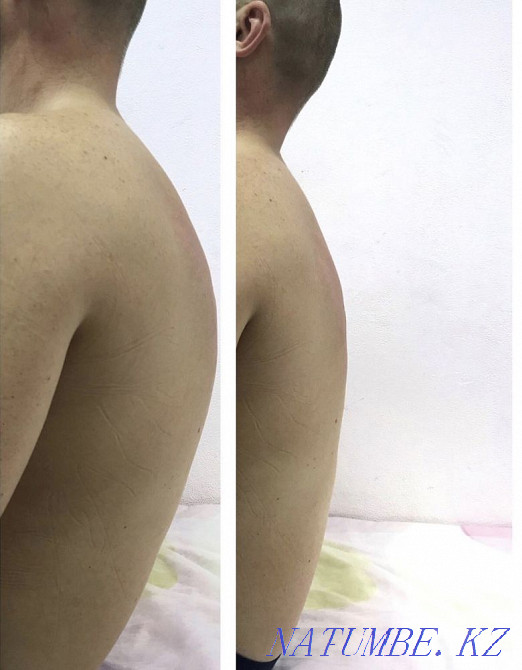 Masseur Astana - photo 4