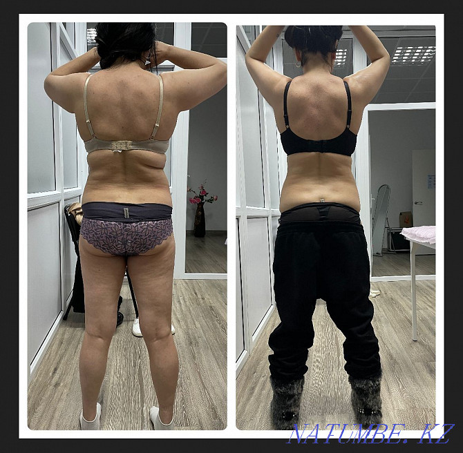 Anti-cellulite massage body shaping Astana - photo 2