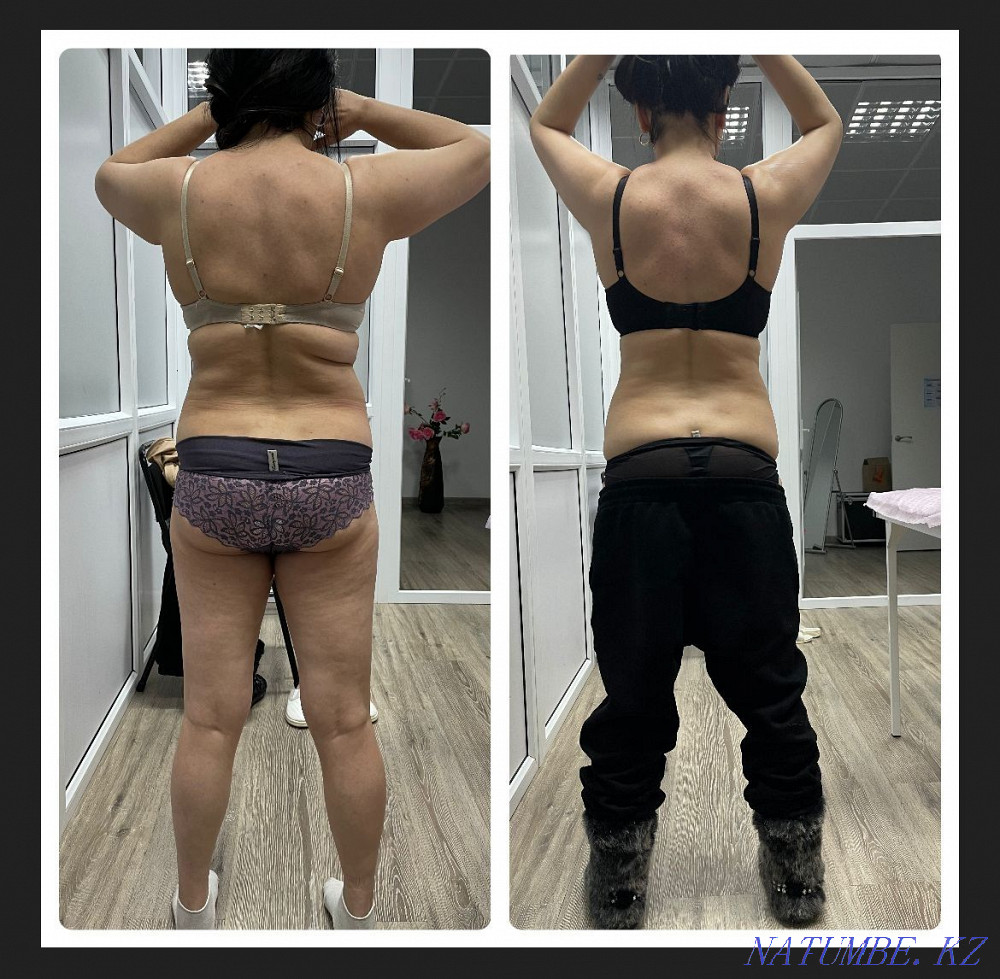 Anti-cellulite massage body shaping Astana - photo 2
