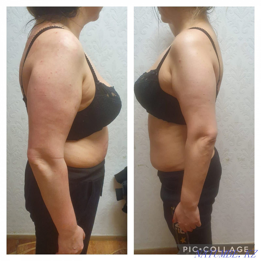 Anti-cellulite massage body shaping Astana - photo 3