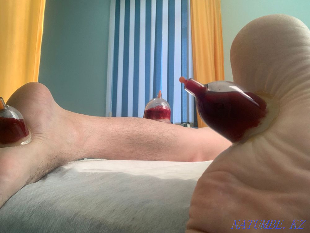 Hijama Massage  - photo 5