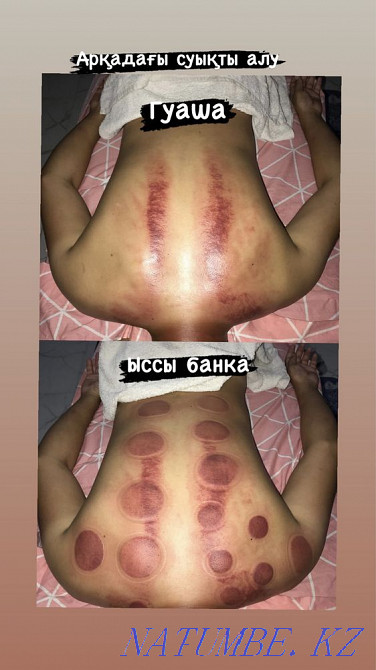 Массаж Мануальный терапия Хиджама Актобе - изображение 4