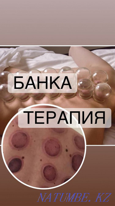 Массаж Мануальный терапия Хиджама Актобе - изображение 2