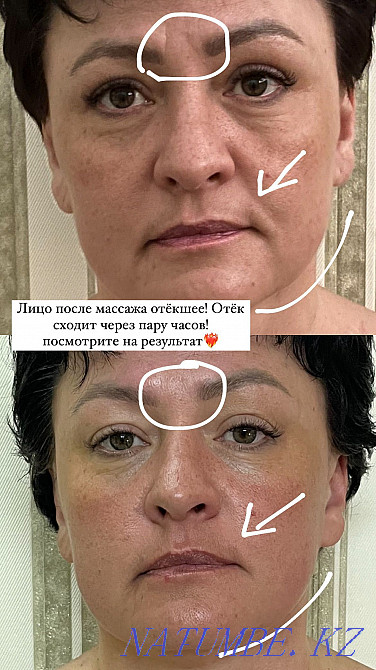 Балийский массаж лица скульптурный (лицо,спина,ШВЗ) Петропавловск - изображение 3