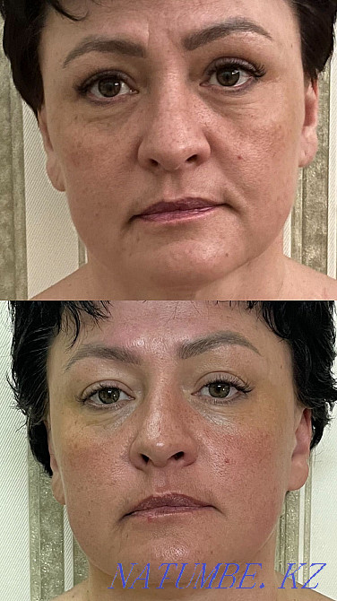 Балийский массаж лица скульптурный (лицо,спина,ШВЗ) Петропавловск - изображение 2