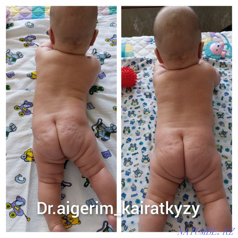 Ұшу кезінде балаларға арналған массаж  Алматы - изображение 2