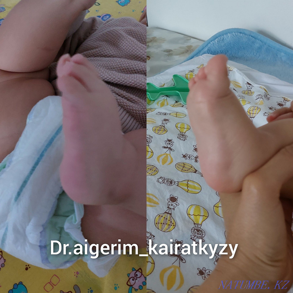 Ұшу кезінде балаларға арналған массаж  Алматы - изображение 4