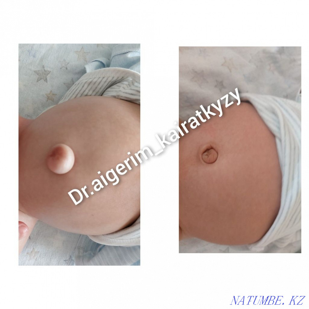 Ұшу кезінде балаларға арналған массаж  Алматы - изображение 3