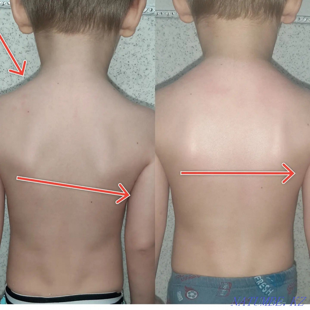 Children's massage and exercise therapy Petropavlovsk - photo 1