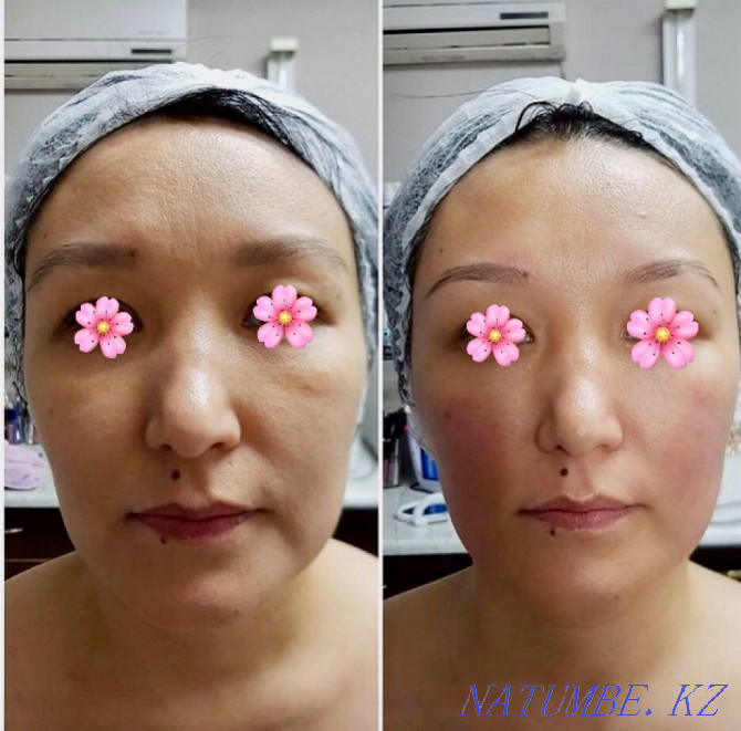 Facial massage Astana - photo 3