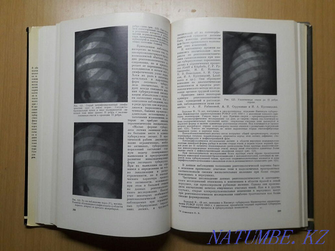 Bookinistry. X-ray diagnosis of pulmonary tuberculosis. Karagandy - photo 6