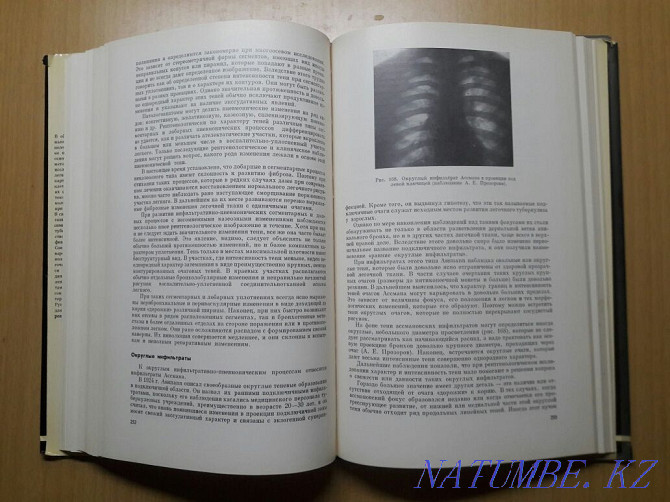 Bookinistry. X-ray diagnosis of pulmonary tuberculosis. Karagandy - photo 5