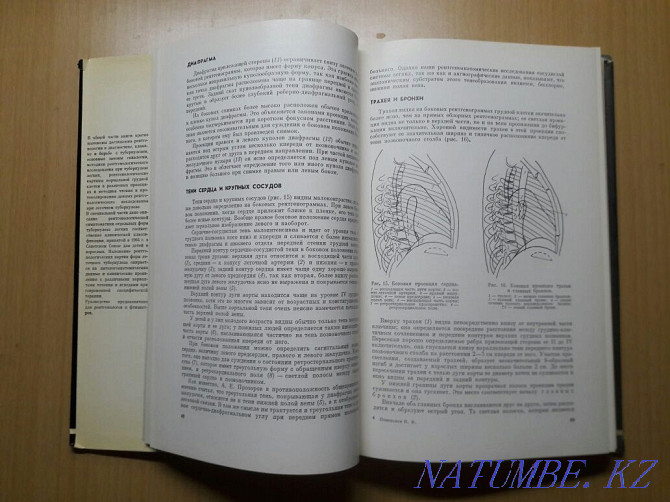 Bookinistry. X-ray diagnosis of pulmonary tuberculosis. Karagandy - photo 8