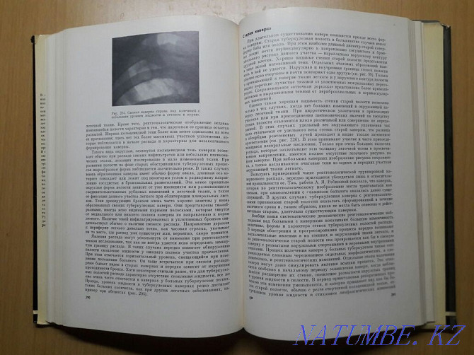 Bookinistry. X-ray diagnosis of pulmonary tuberculosis. Karagandy - photo 4