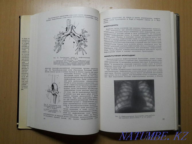 Bookinistry. X-ray diagnosis of pulmonary tuberculosis. Karagandy - photo 7