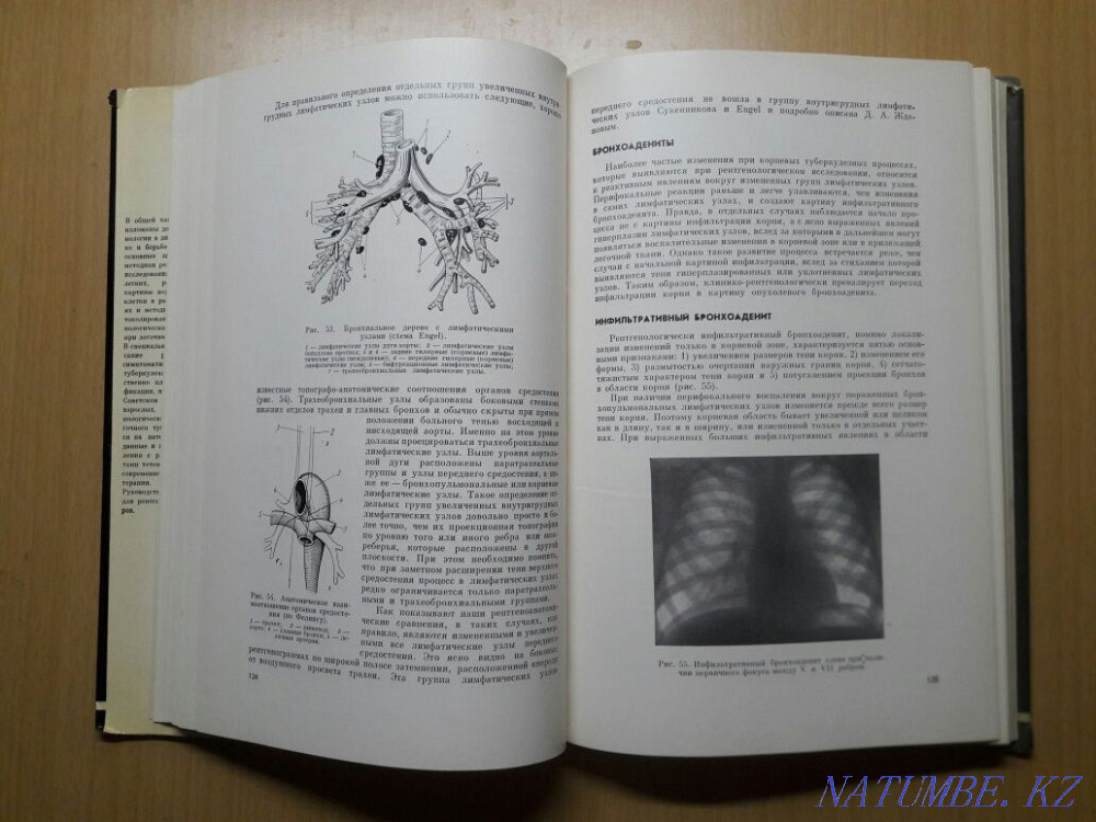Кітапхана. Өкпе туберкулезінің рентгендік диагностикасы.  Қарағанды - изображение 7