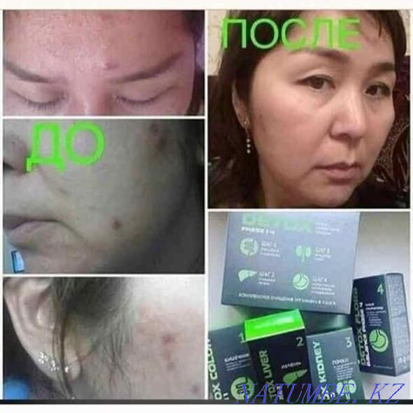 I accept orders for NL products. Karagandy - photo 5