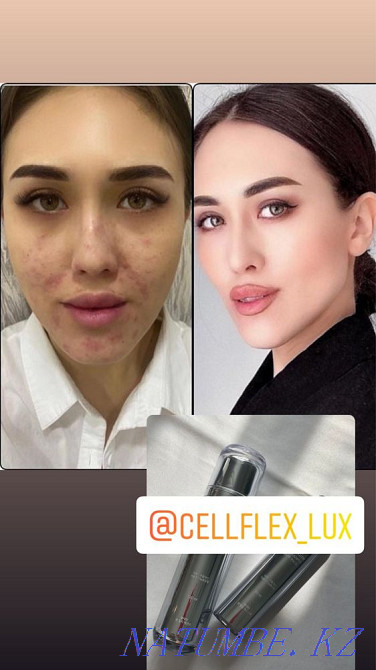 Essence and ampoule mask Astana - photo 1