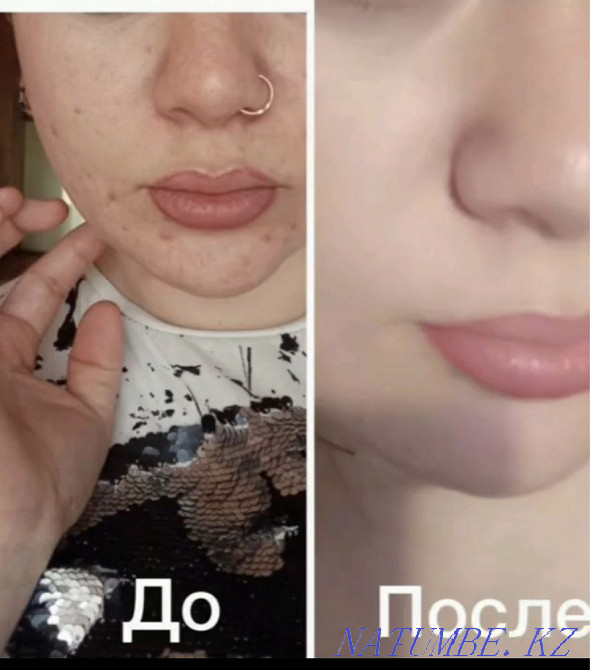 Essence and ampoule mask Astana - photo 5