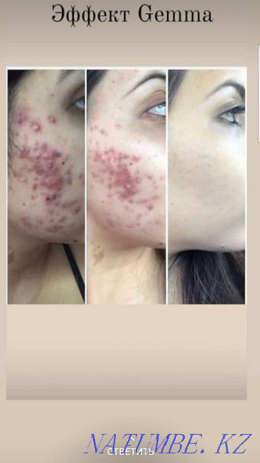 Продам сеты корейской косметики gemma Муткенова - изображение 2