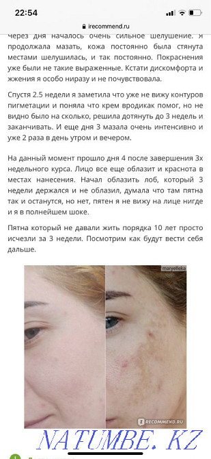 Expigment original cream for blackheads and pigmentation Almaty - photo 5