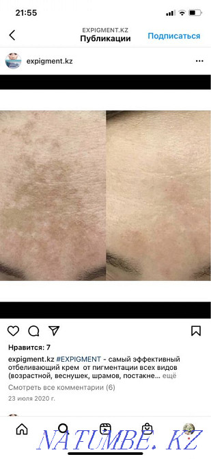 Expigment original cream for blackheads and pigmentation Almaty - photo 3