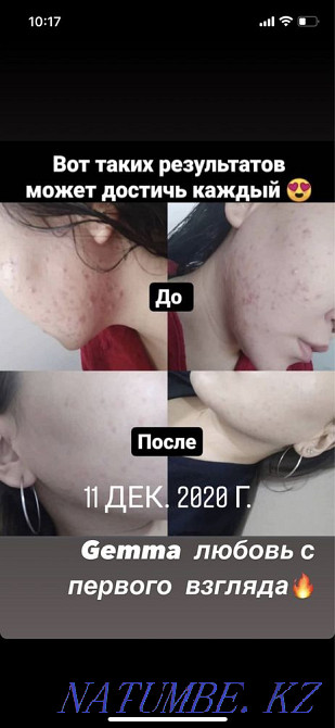 уходовая косметика Gemma Джемма Астана - изображение 3