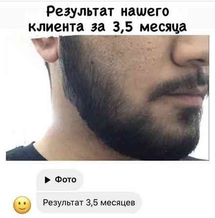 Миноксидил для роста водос и бороды. Minoxidil Kirkland.  Астана