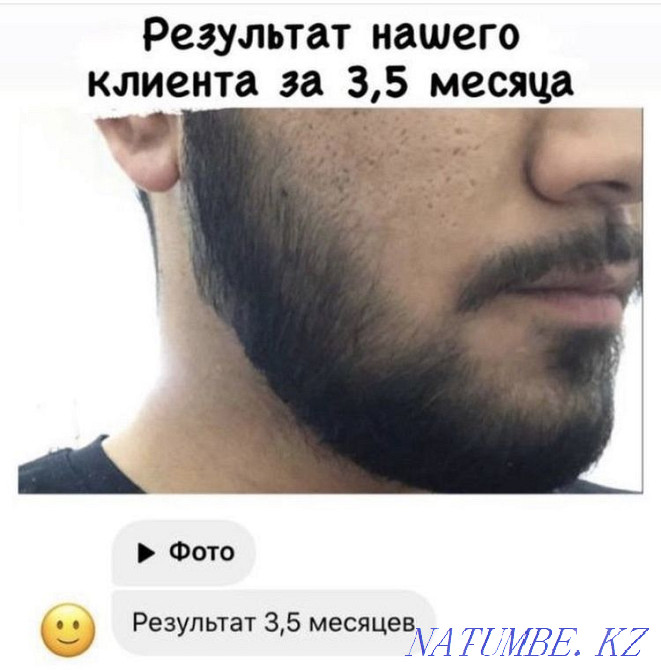 Minoxidil for hair and beard growth. Minoxidil Kirkland. Astana - photo 1