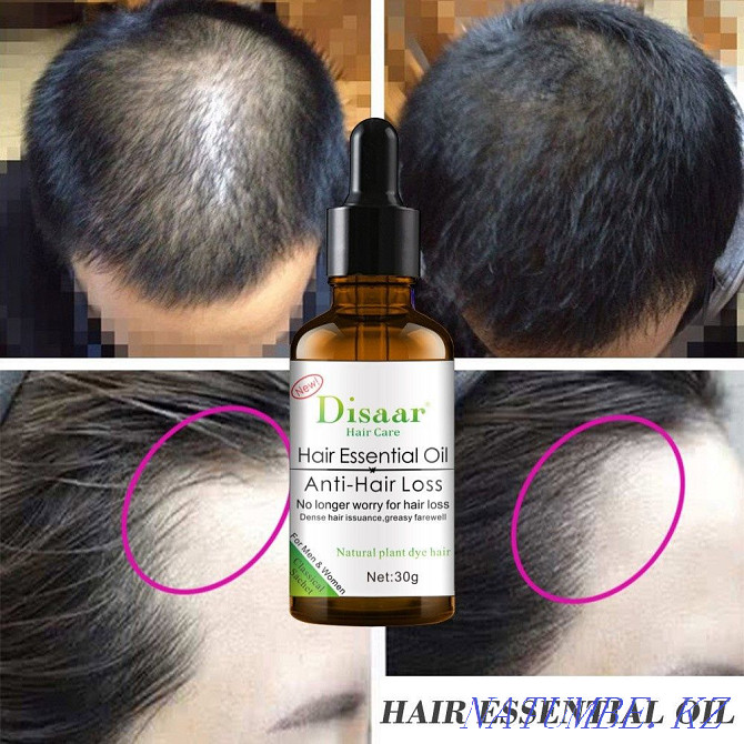 Disaar/serum+shampoo/kit/baldness/hair loss Almaty - photo 7