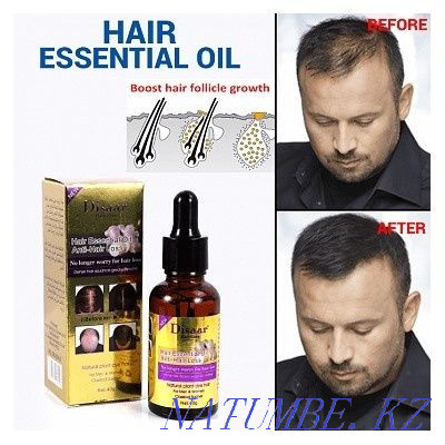 Disaar/serum+shampoo/kit/baldness/hair loss Almaty - photo 5