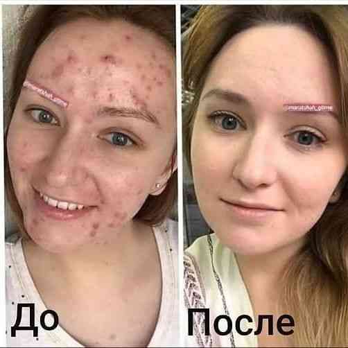 Продаю ШУНГИТОВОЕ МЫЛО+доставка. со скидкой, упаковка 4000 тг=4 штуки Астана