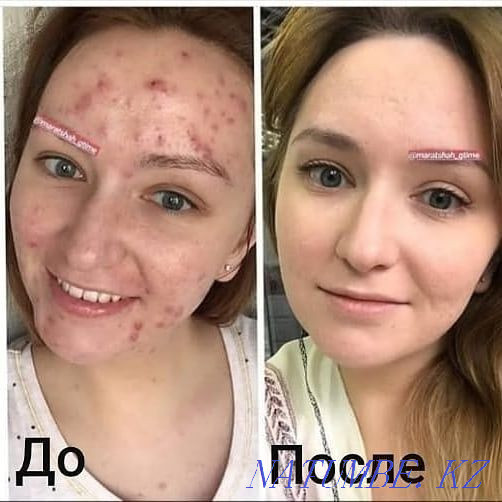 Продаю ШУНГИТОВОЕ МЫЛО+доставка. со скидкой, упаковка 4000 тг=4 штуки Астана - изображение 5